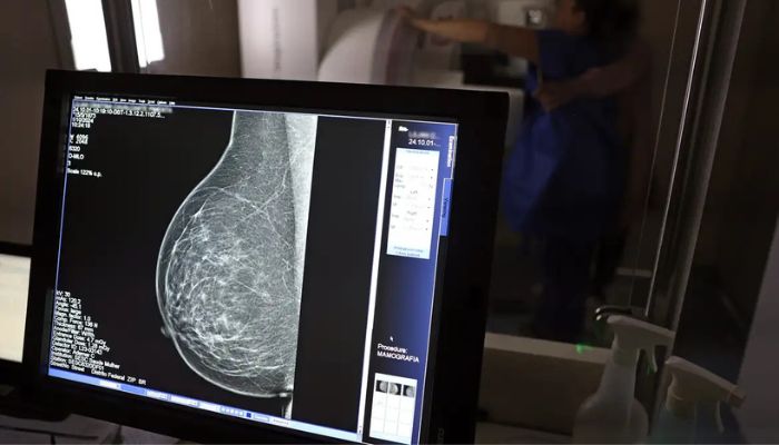 © José Cruz/Agência Brasil Câncer de mama: uma em cada três pacientes tem menos de 50 anos